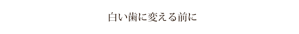 白い歯に変える前に