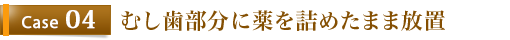 Case4	むし歯部分に薬を詰めたまま放置