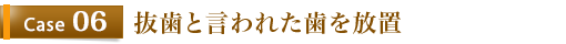 Case6	抜歯と言われた歯を放置