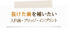 抜けた歯を補いたい入れ歯・ブリッジ・インプラント