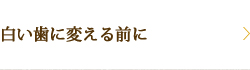 白い歯に変える前に